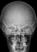 Proyección PA Cráneo